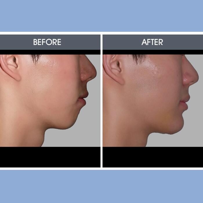 Images Darrick E. Antell M.D., F.A.C.S.