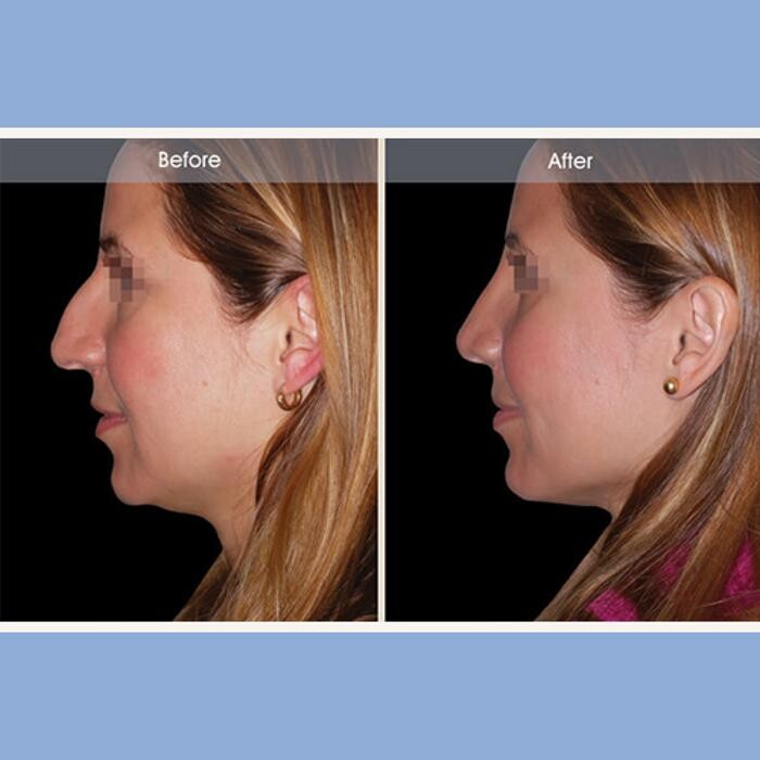 Images Darrick E. Antell M.D., F.A.C.S.