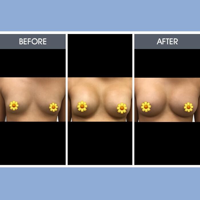 Images Darrick E. Antell M.D., F.A.C.S.
