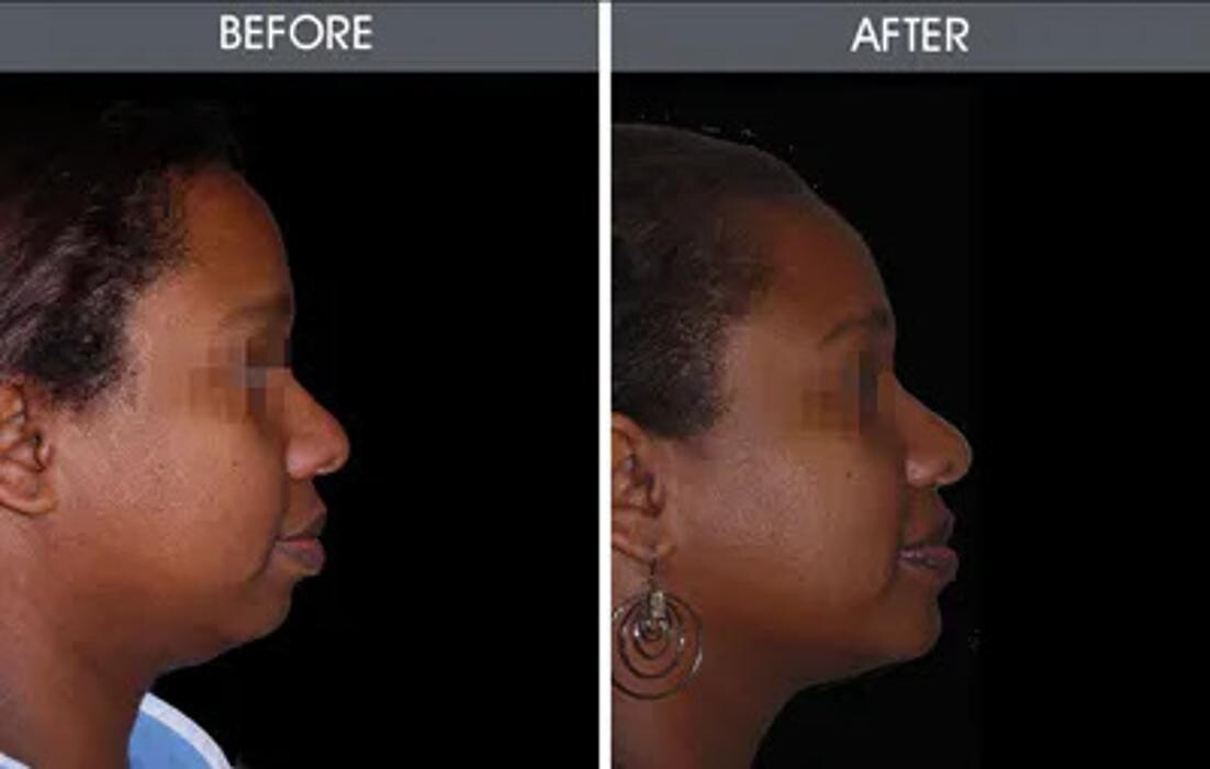 Images Darrick E. Antell M.D., F.A.C.S.