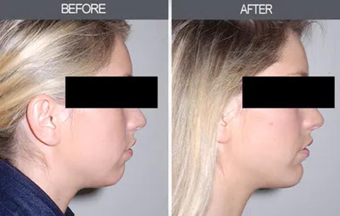 Images Darrick E. Antell M.D., F.A.C.S.