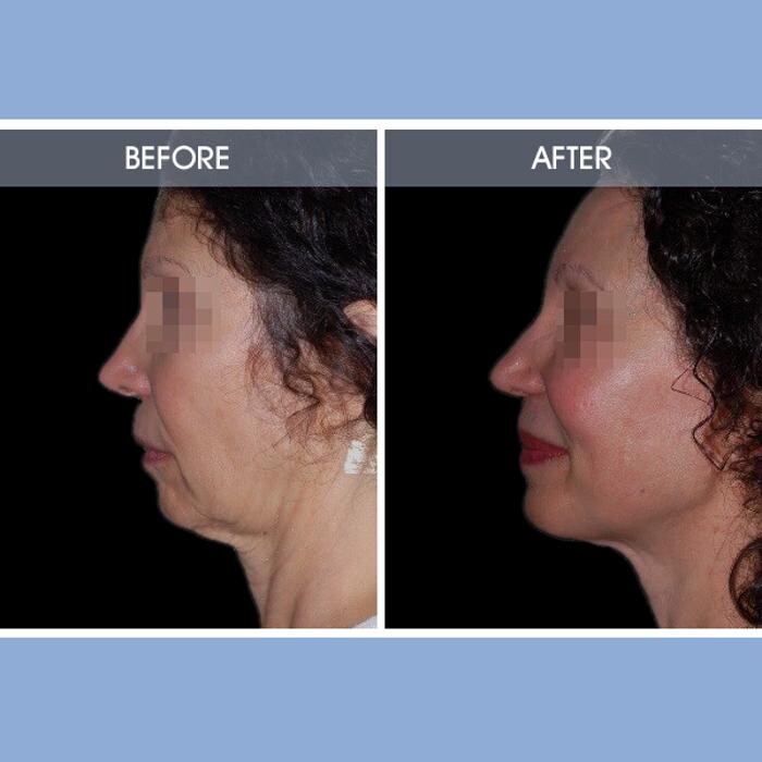 Images Darrick E. Antell M.D., F.A.C.S.