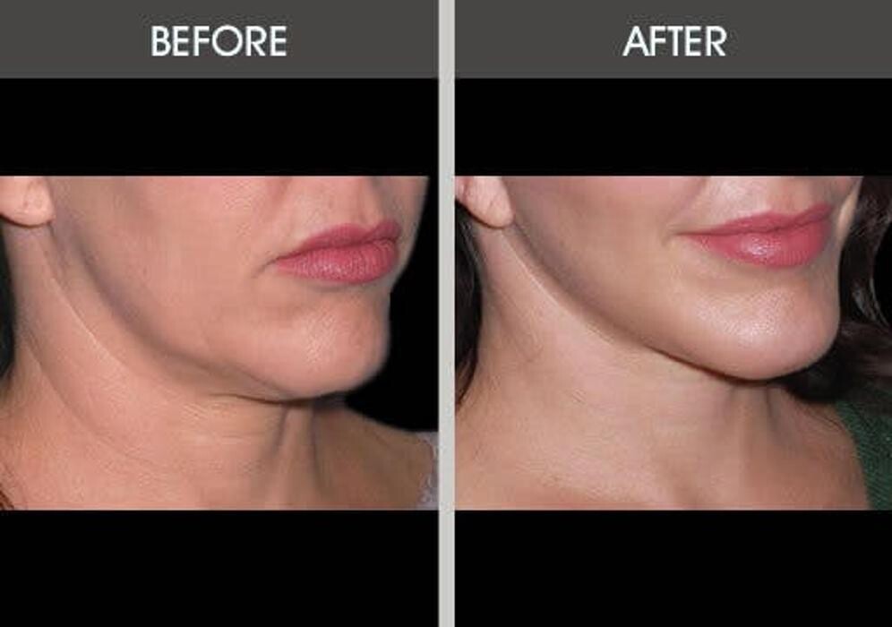 Images Darrick E. Antell M.D., F.A.C.S.