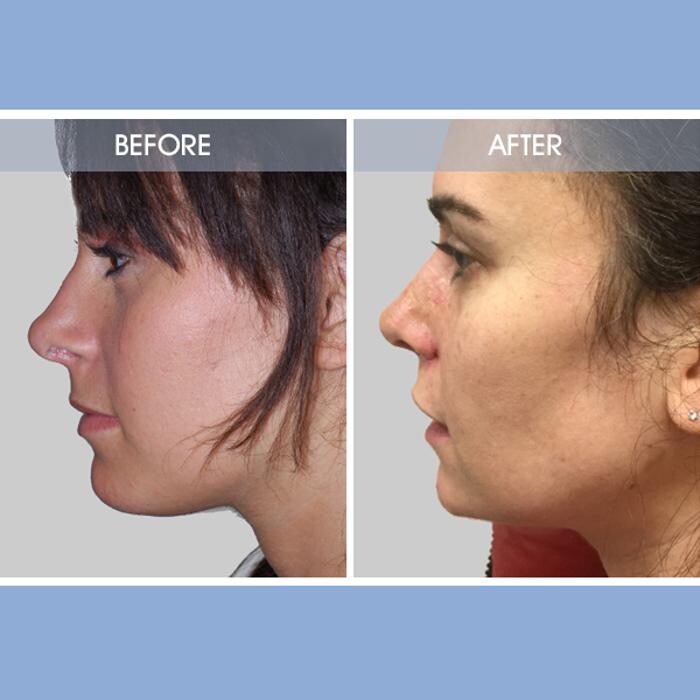 Images Darrick E. Antell M.D., F.A.C.S.