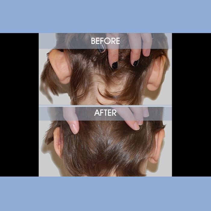 Images Darrick E. Antell M.D., F.A.C.S.
