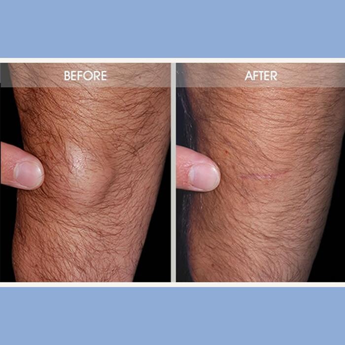 Images Darrick E. Antell M.D., F.A.C.S.