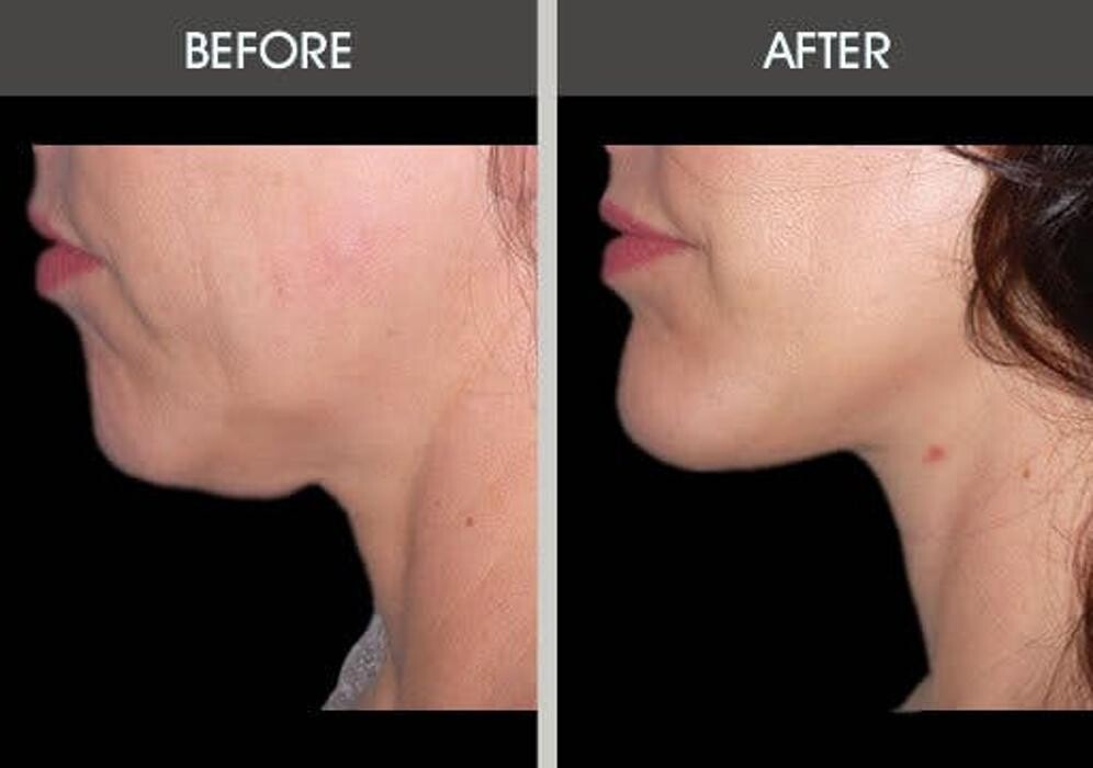 Images Darrick E. Antell M.D., F.A.C.S.