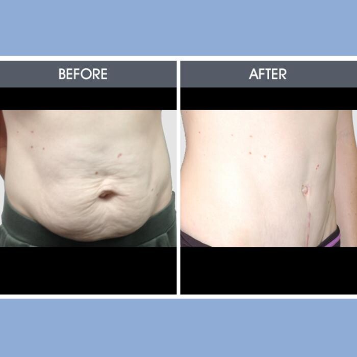Images Darrick E. Antell M.D., F.A.C.S.