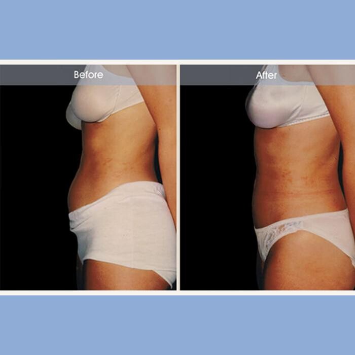 Images Darrick E. Antell M.D., F.A.C.S.