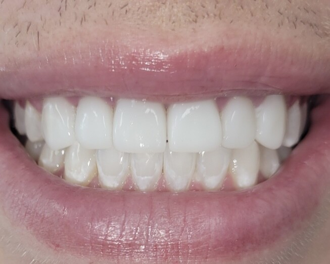 Images Dr. Whyte Smile