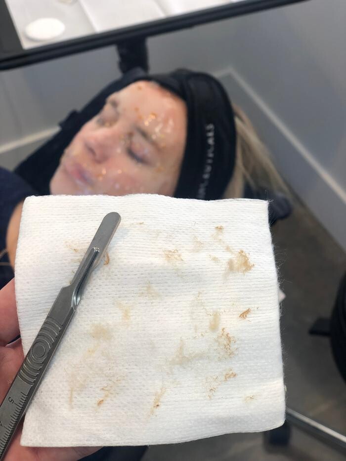 Images Lux Injections