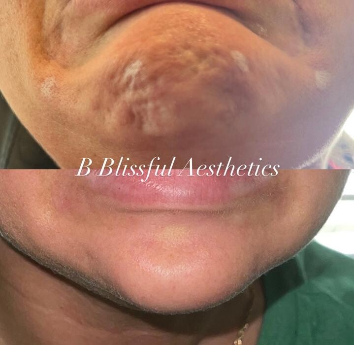 Images B Blissful Aesthetics
