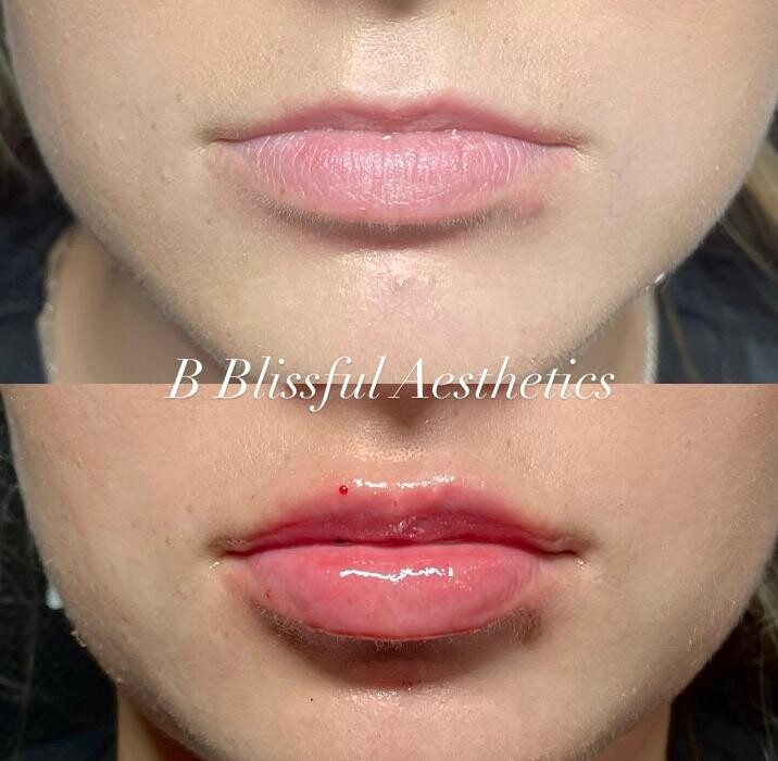 Images B Blissful Aesthetics