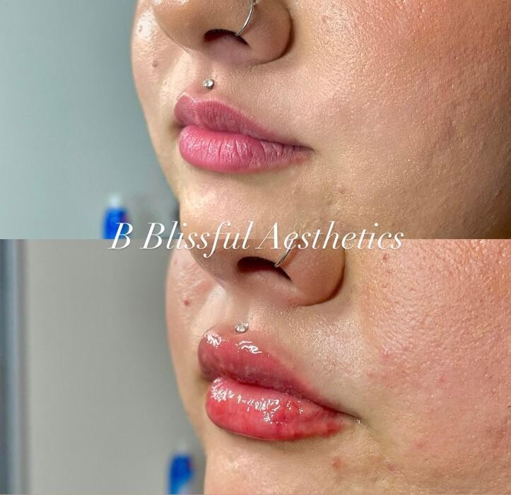 Images B Blissful Aesthetics