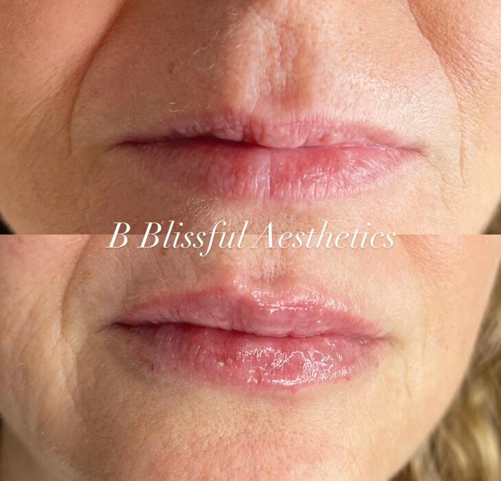 Images B Blissful Aesthetics