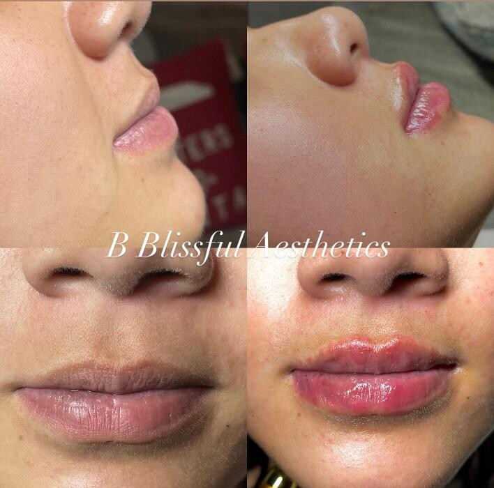 Images B Blissful Aesthetics
