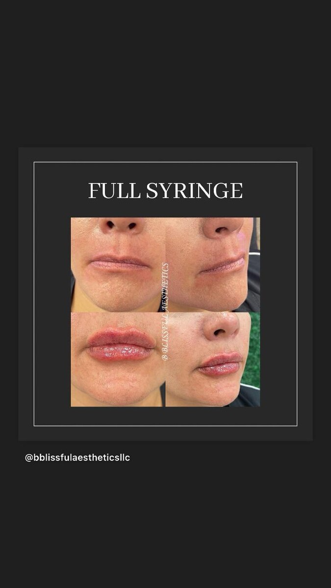 Images B Blissful Aesthetics