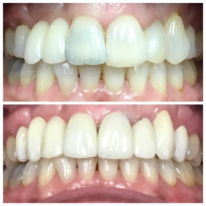 Images Risas Dental and Braces - Maryvale
