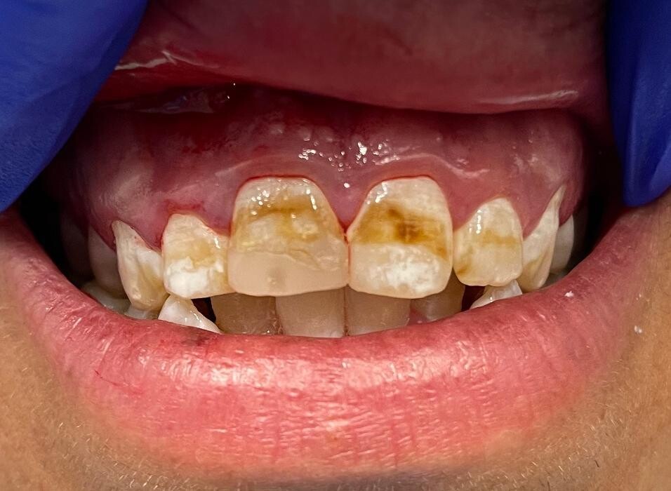 Images Risas Dental and Braces - Commerce City