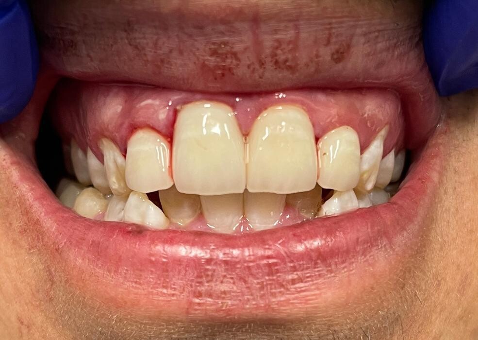 Images Risas Dental and Braces - Commerce City