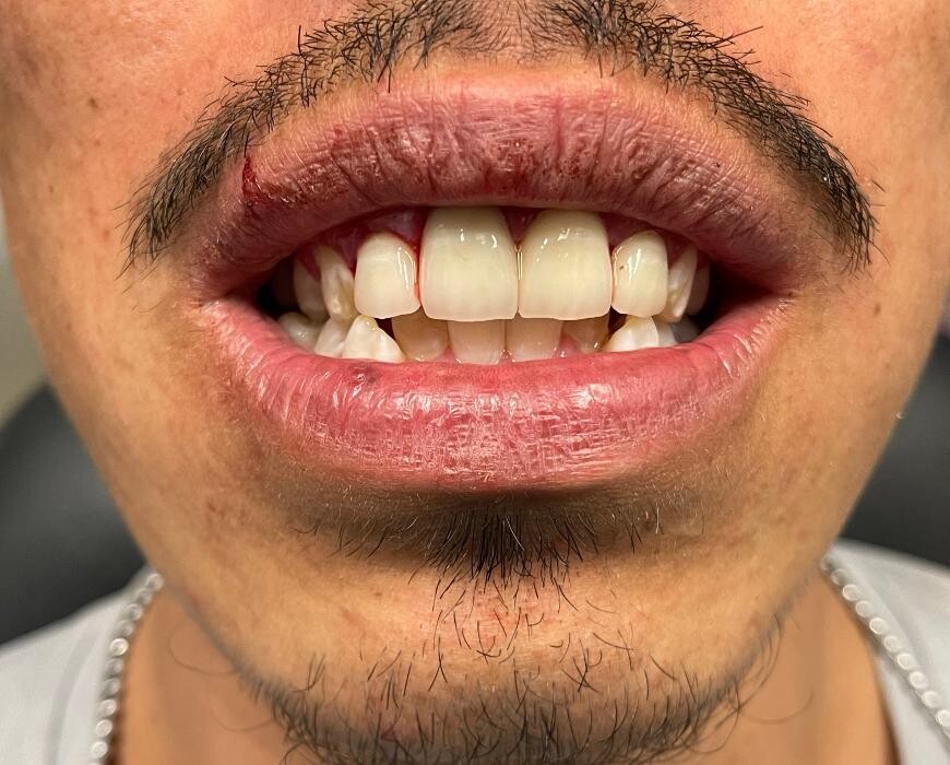 Images Risas Dental and Braces - Commerce City