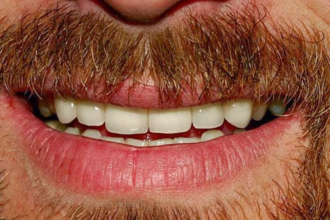 Images Smile Select Dental Chino Hills