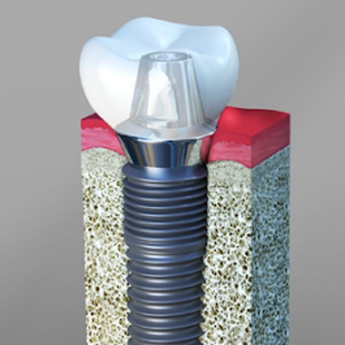 Images Smile Select Dental Chino Hills