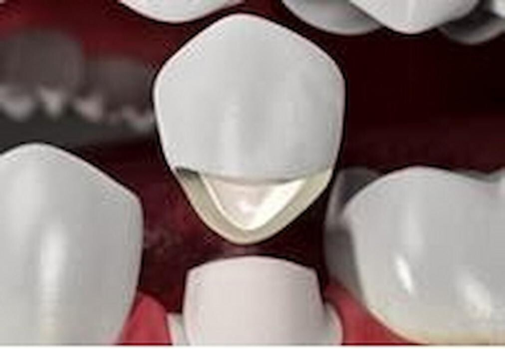 Images Smile Select Dental Chino Hills