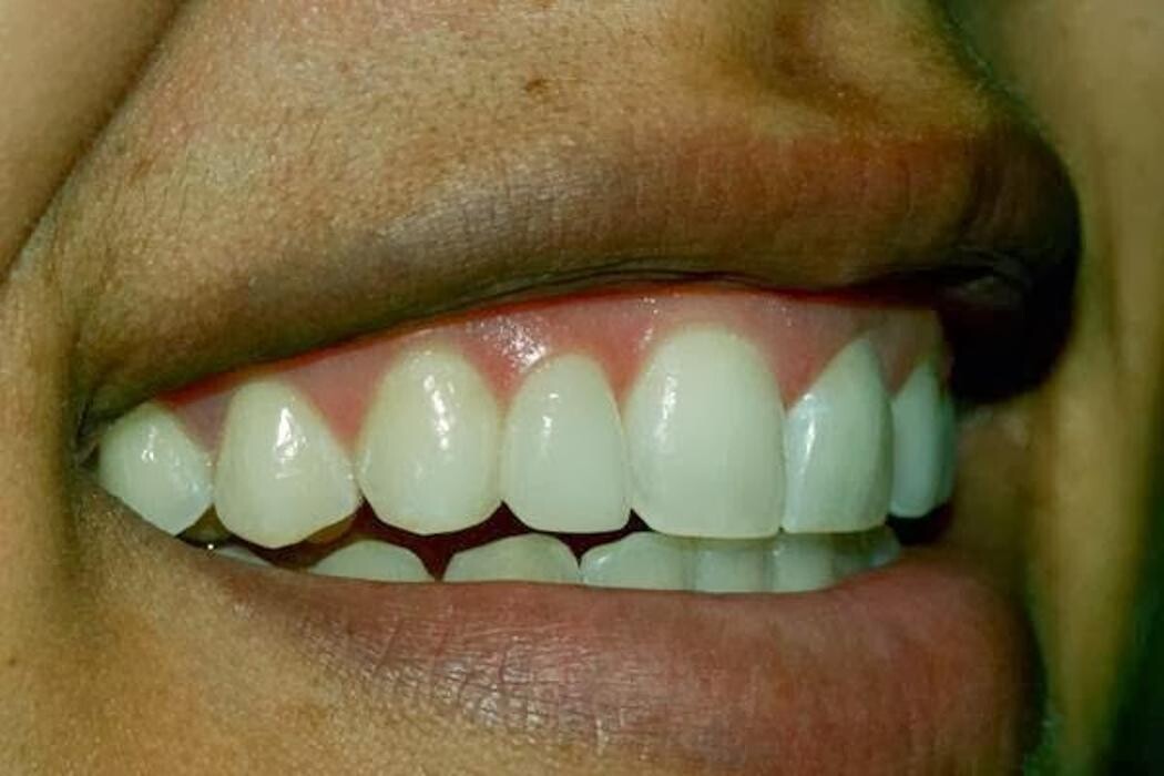 Images Smile Select Dental Chino Hills