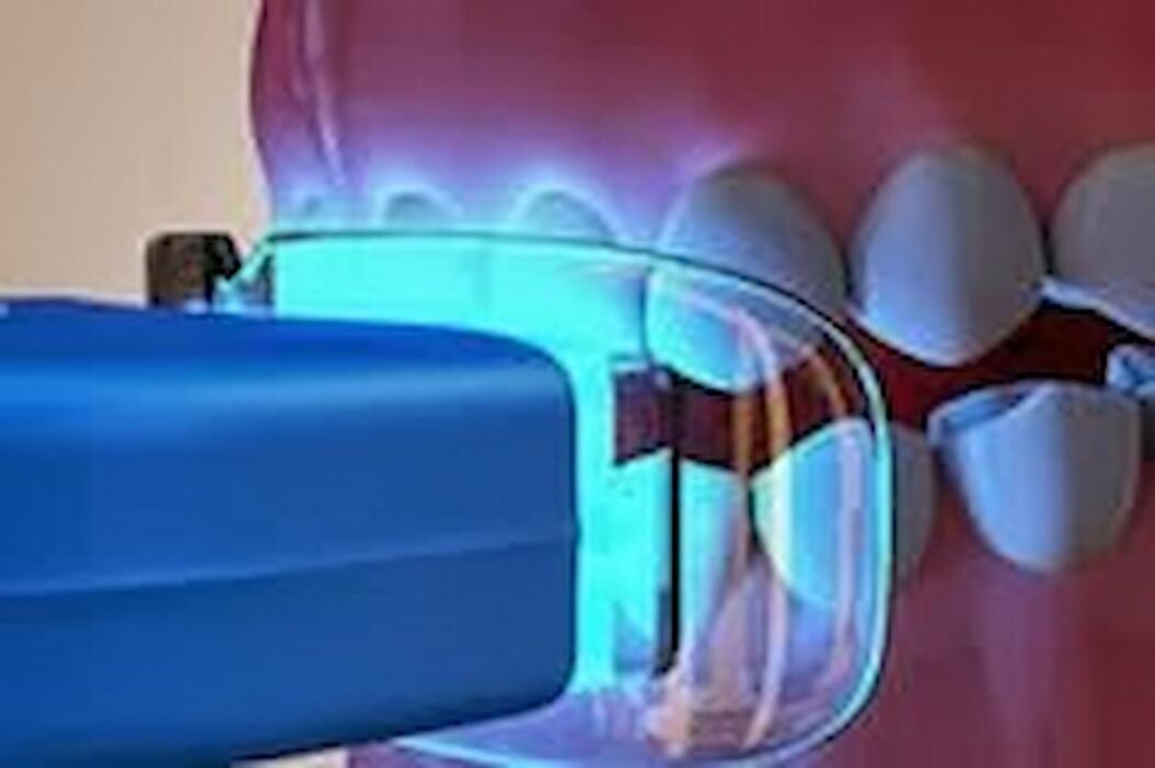 Images Smile Select Dental Chino Hills