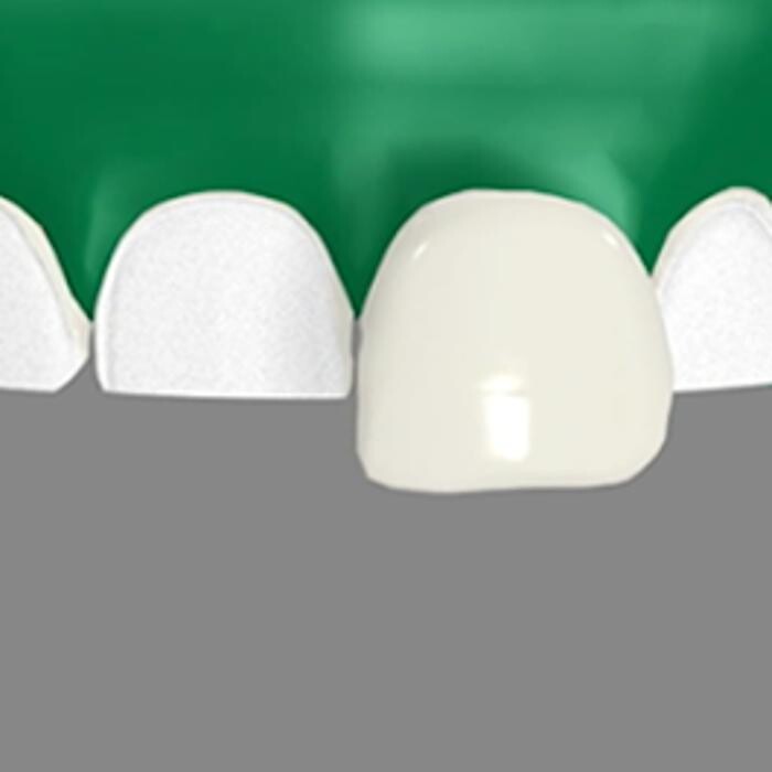 Images Smile Select Dental Chino Hills