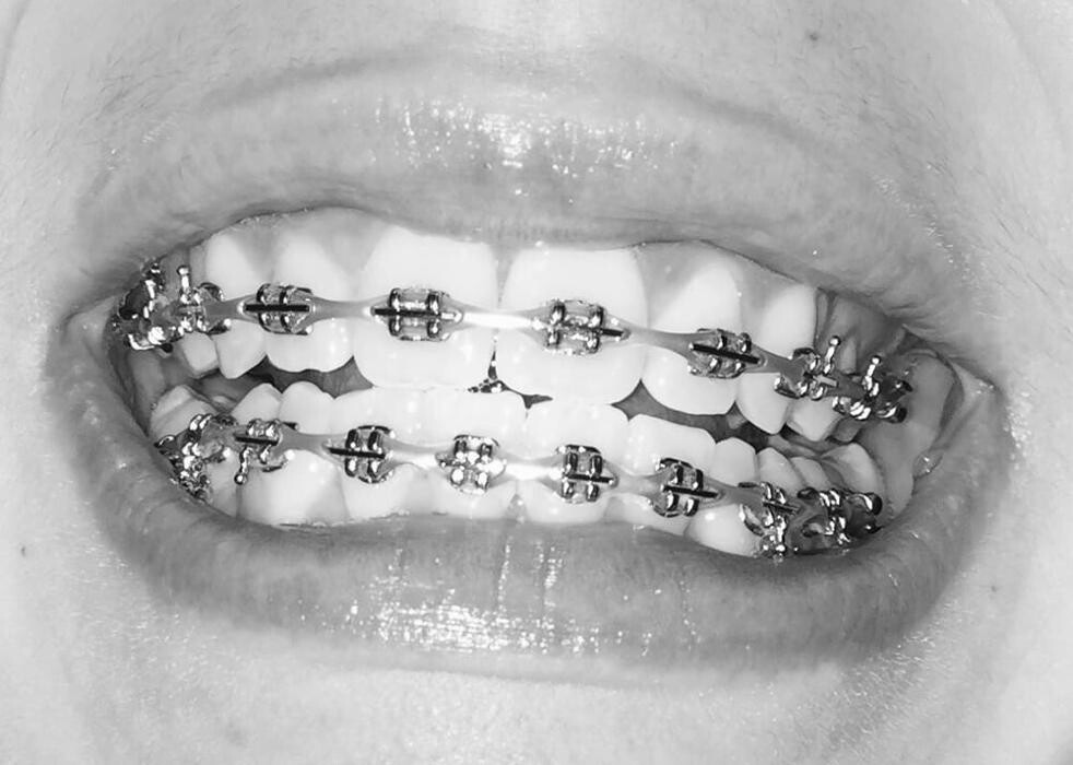 Images Risas Dental and Braces - Metro
