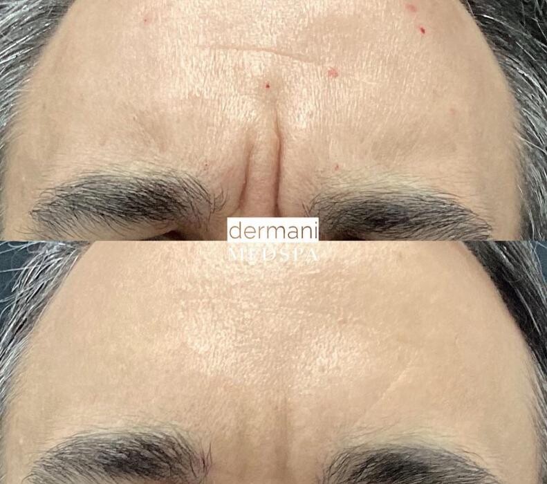 Images dermani MEDSPA Kennesaw