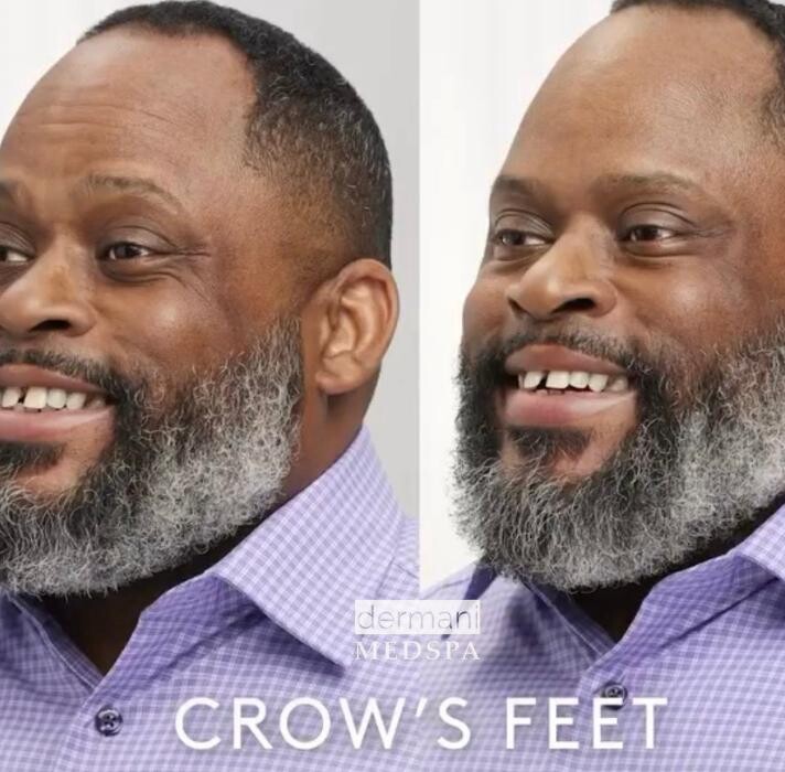 Images dermani MEDSPA Kennesaw