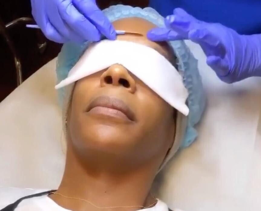 Images dermani MEDSPA Kennesaw