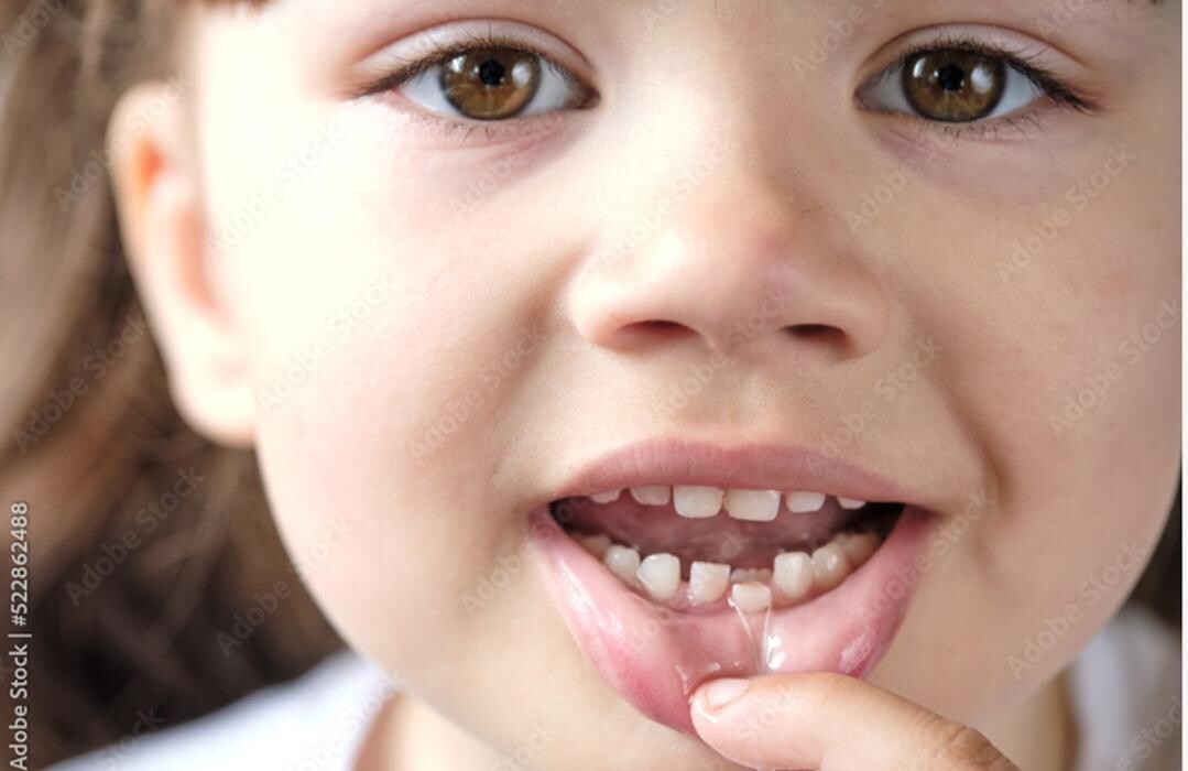 Images Smileworld Pediatric Dentistry - Lorton