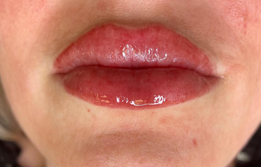 Images Medical Aesthetics Of North Houston