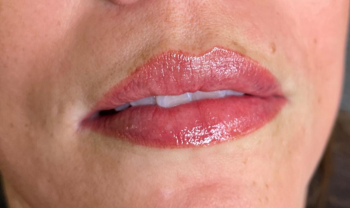 Images Medical Aesthetics Of North Houston