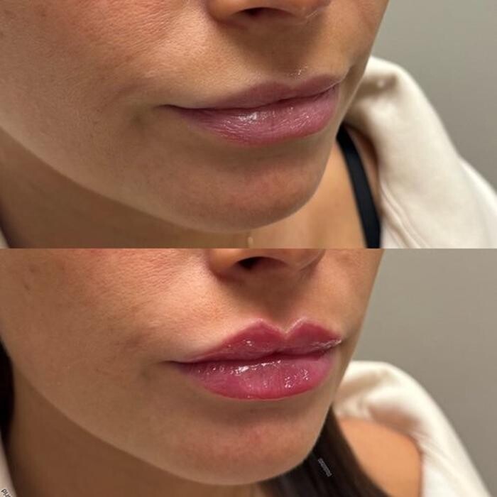 Images Metamorph Med Spa