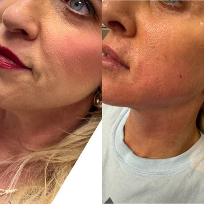 Images Metamorph Med Spa