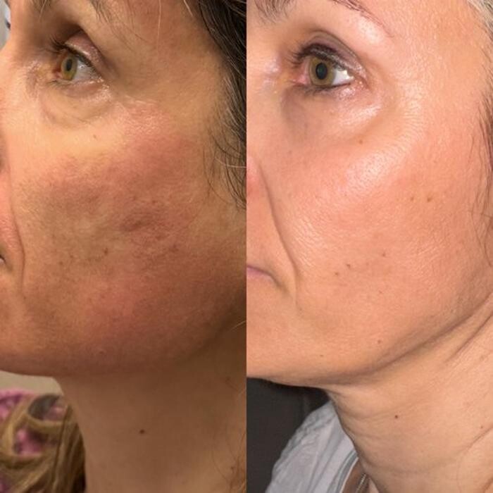 Images Metamorph Med Spa
