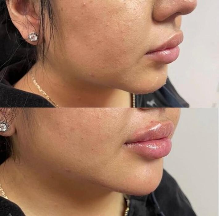 Images Metamorph Med Spa
