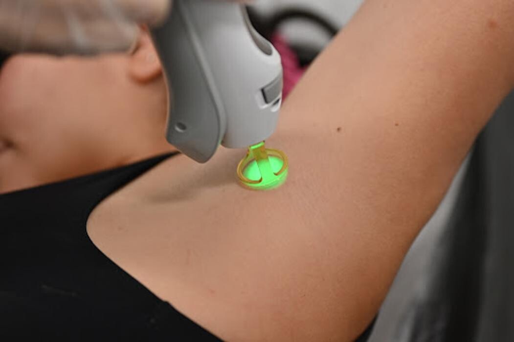 Images Jes Laser