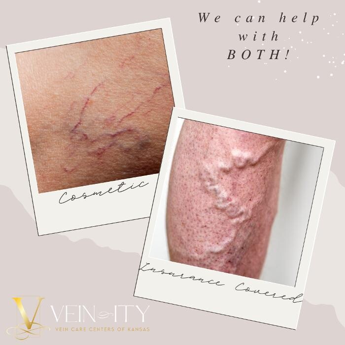 Images Vein-ity Vein Care Centers of Kansas
