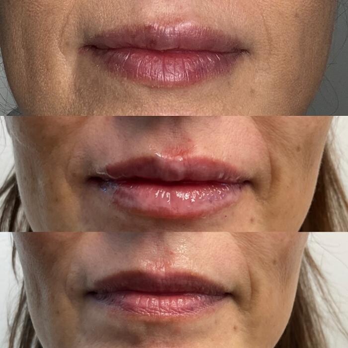 Images Santa Monica Medical Aesthetics