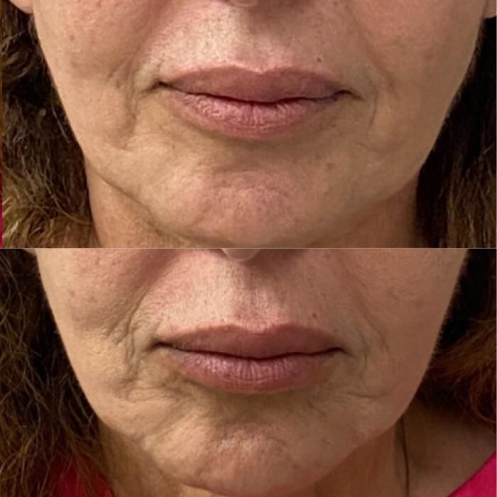 Images Santa Monica Medical Aesthetics