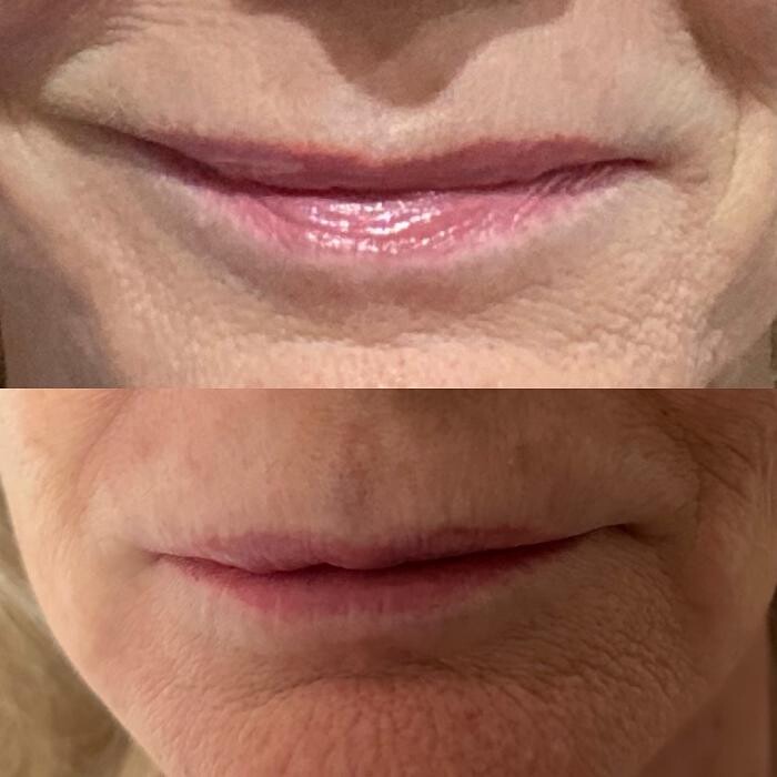 Images Santa Monica Medical Aesthetics