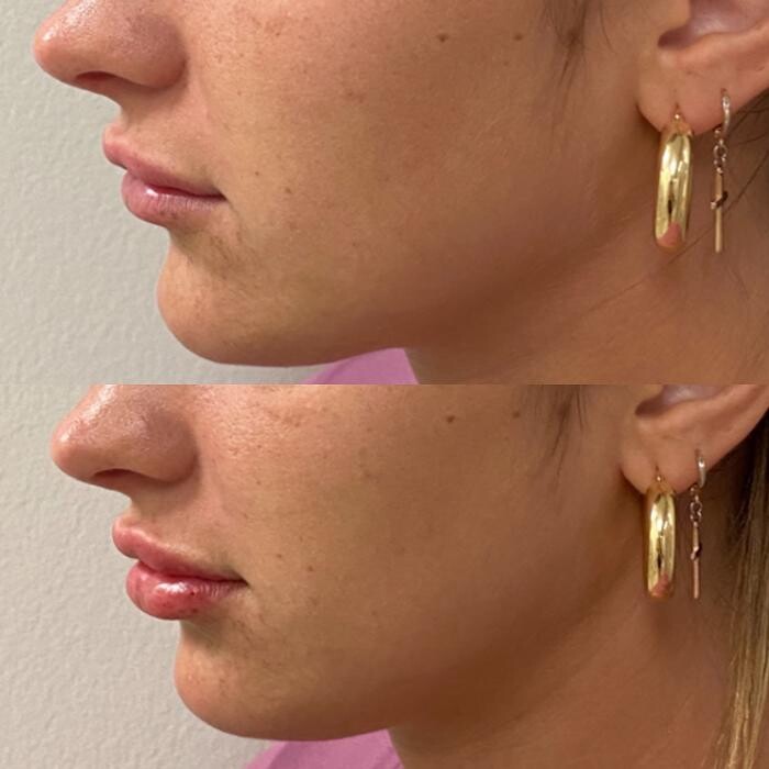 Images Santa Monica Medical Aesthetics