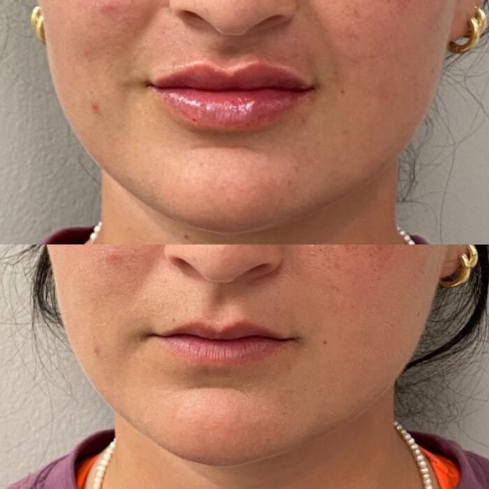 Images Santa Monica Medical Aesthetics