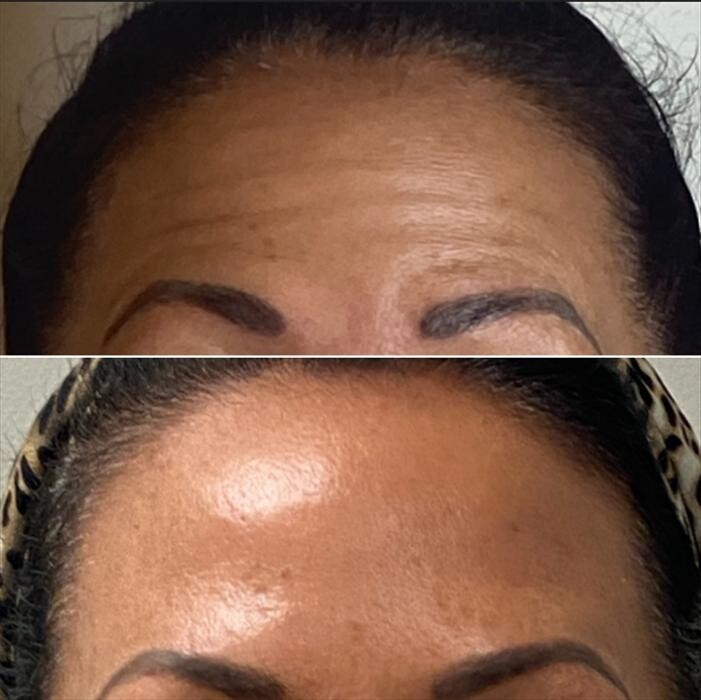 Images Santa Monica Medical Aesthetics